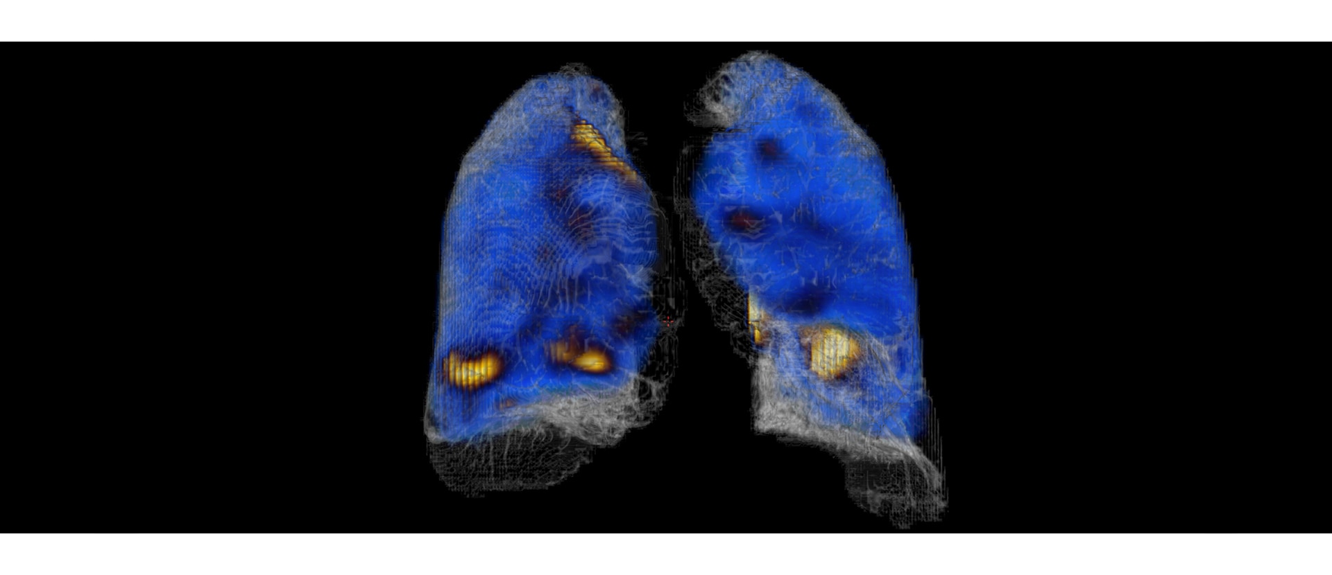 GEHC Xeleris 4 DR Q Lung Image 1 v1