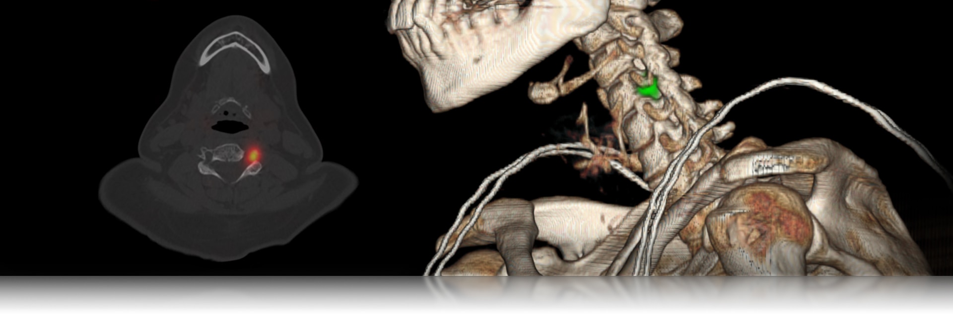 GEHCMILandingPageUpdatesNuclearMedicineImage1