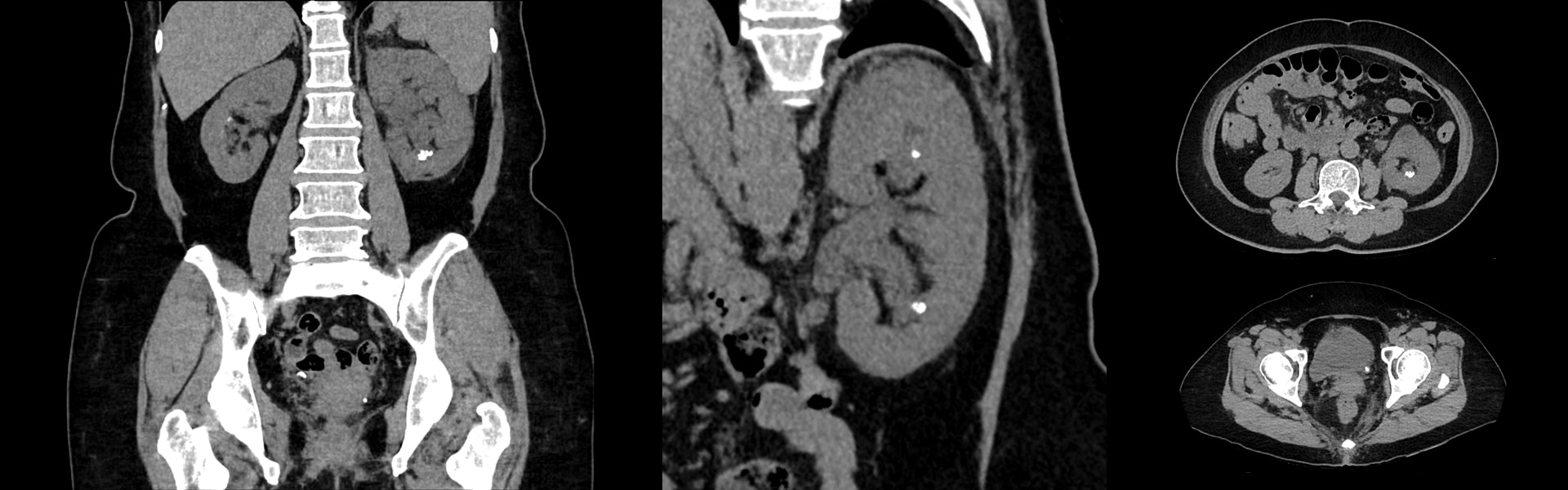 GEHC DMIG2 Product Web Page Benefits Diagnostic CT Image 1