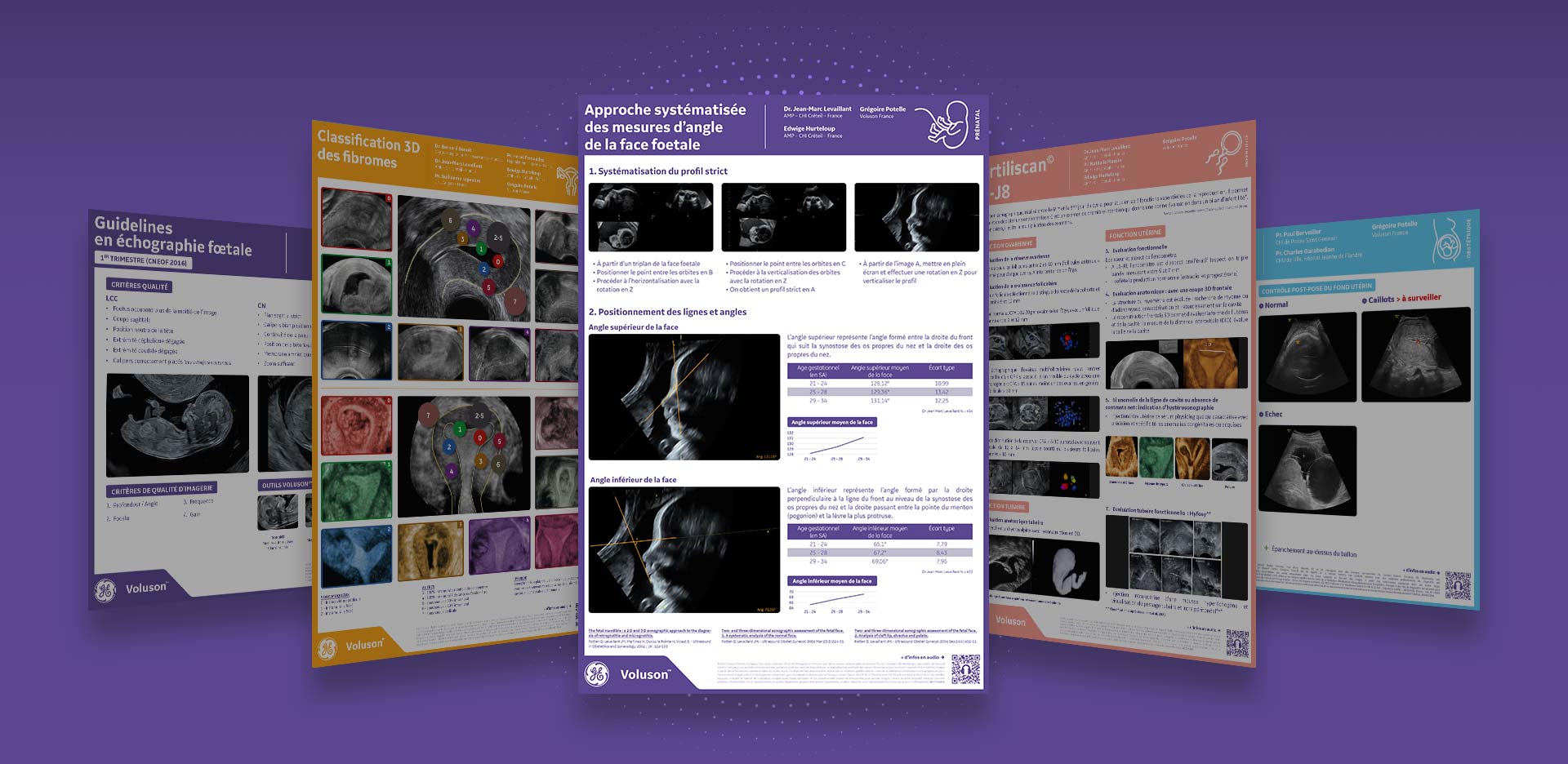 POSTERS-VOLUSON-A3-GEHEALTHCARE-prenatal-approche-systematisee-mesures-angle-face-foetale-v2