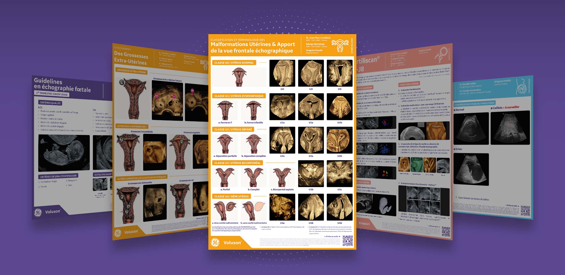 malformations-uterines-full