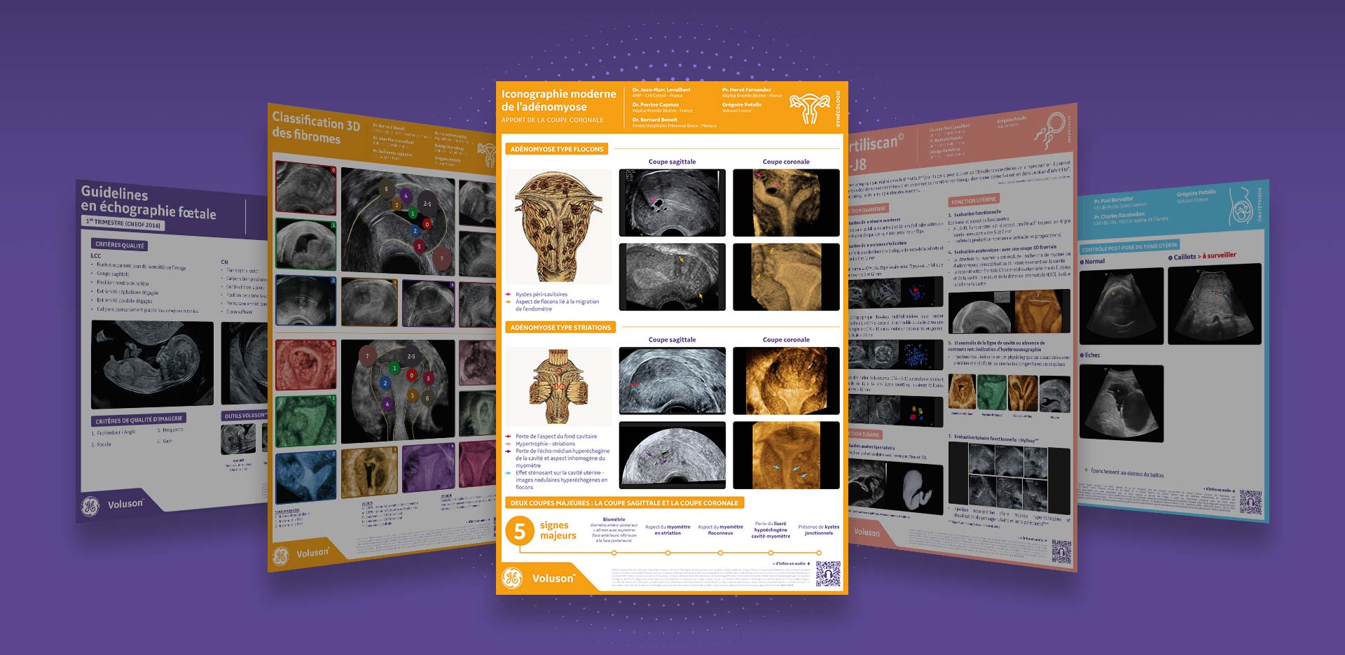 image-full-adenomyose