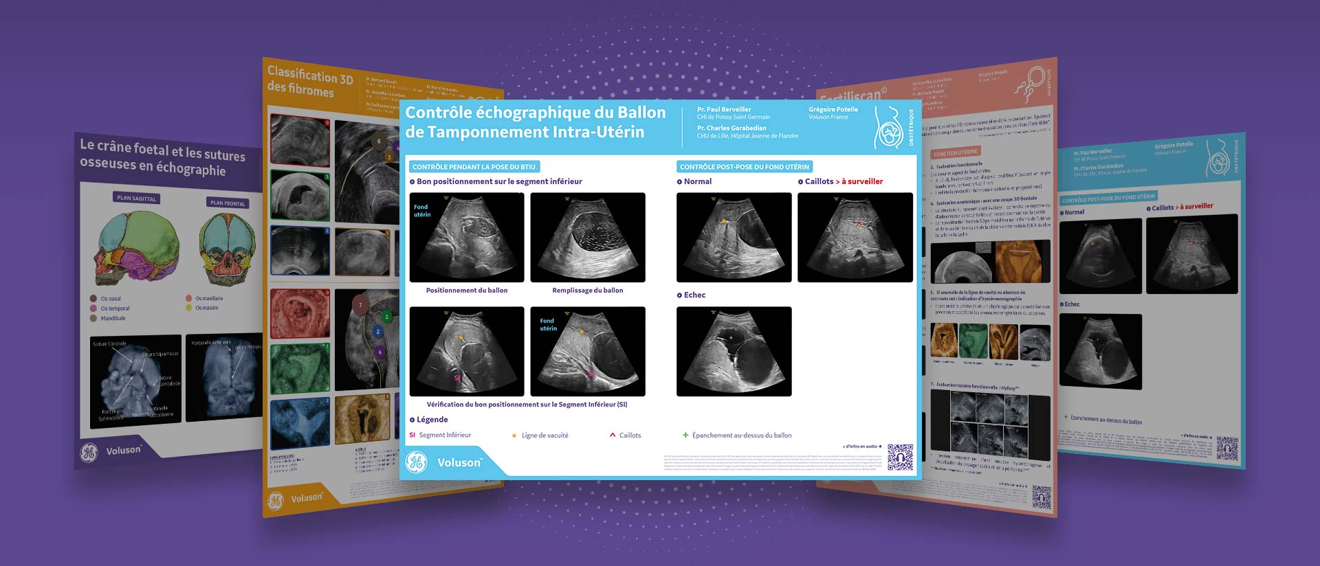 image-full2-pose-ballon