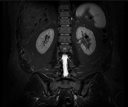 categories-magnetic-resonance-imaging-signa artist-signa-rtist-webpage-define-image-new.jpg