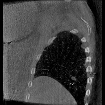 product-product-categories-Intervantional - 2016-needle_31.jpg