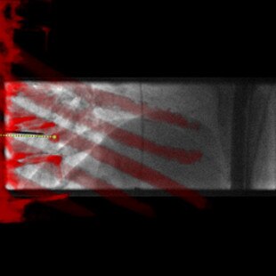 product-product-categories-Intervantional - 2016-needle_32.jpg